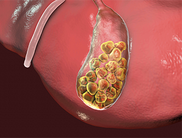 Homeopathy Treatment for Autism Spectrum Disorder (ASD) in Pammal